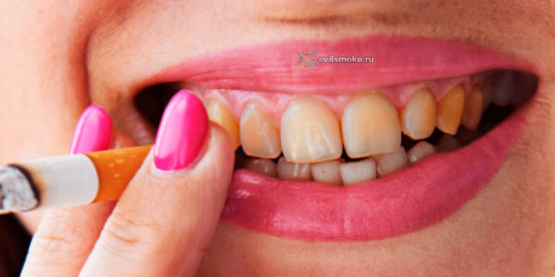 Фото - Пожелтевшие зубы от долгого курения